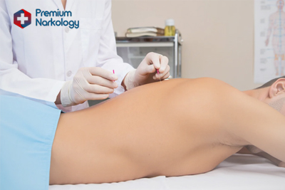 Доктор проводит процесс иглоукалывания